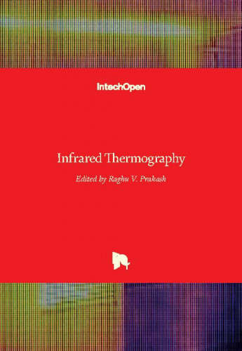 Infrared thermography / edited by Raghu V. Prakash