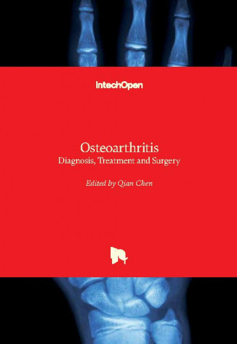 Osteoarthritis - diagnosis, treatment and surgery / edited by Qian Chen