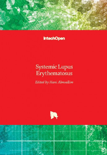 Systemic lupus erythematosus / edited by Hani Almoallim