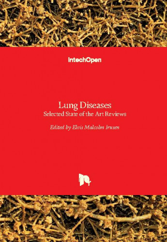 Lung diseases - selected state of the art reviews / edited by Elvis Malcolm Irusen