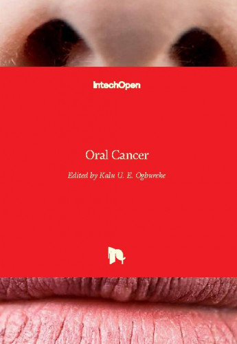 Oral cancer / edited by Kalu U. E. Ogbureke