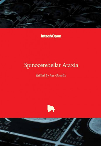 Spinocerebellar ataxia / edited by Jose Gazulla