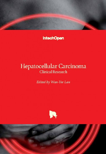 Hepatocellular carcinoma - clinical research / edited by Wan-Yee Lau