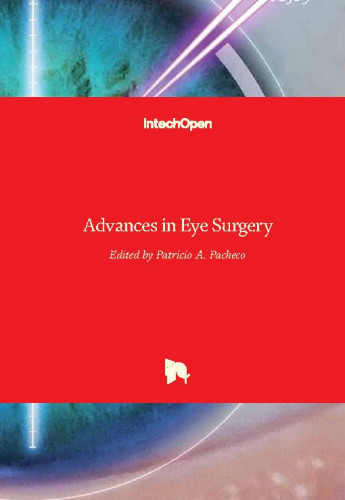 Advances in eye surgery / edited by Patricio A. Pacheco