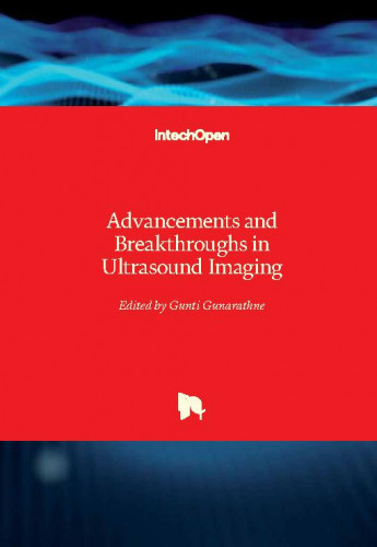 Advancements and breakthroughs in ultrasound imaging / edited by Gunti Gunarathne