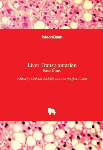 Liver transplantation - basic issues edited by Hesham Abdeldayem and Naglaa Allam