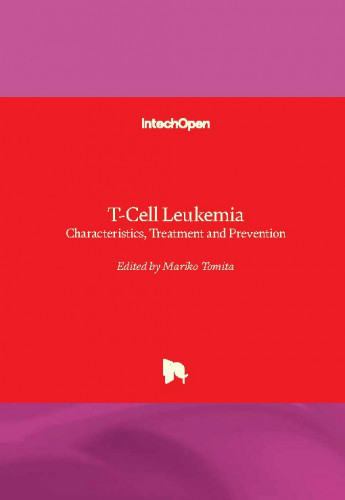 T-Cell leukemia : characteristics, treatment and prevention / edited by Mariko Tomita