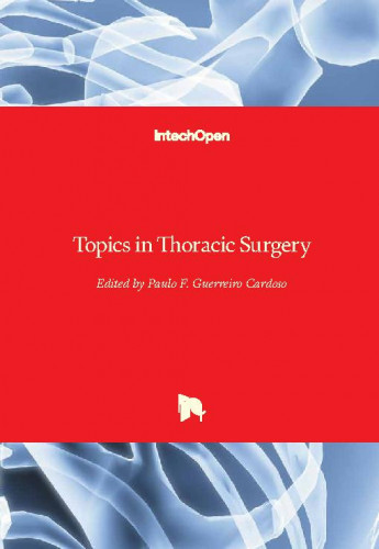 Topics in thoracic surgery edited by Paulo F. Guerreiro Cardoso