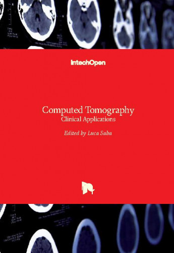 Computed tomography - clinical applications edited by Luca Saba