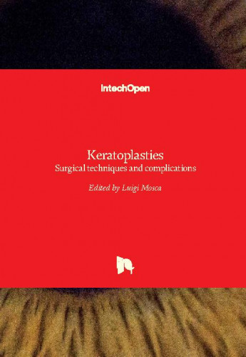 Keratoplasties - surgical techniques and complications edited by Luigi Mosca