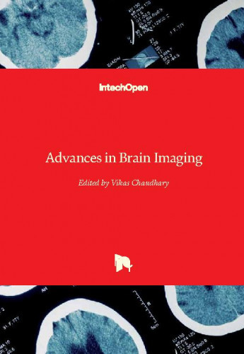 Advances in brain imaging   / edited by Vikas Chaudhary