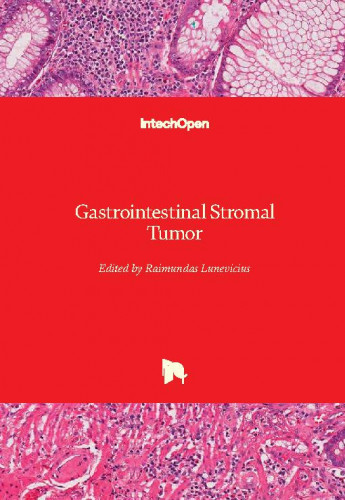 Gastrointestinal stromal tumor / edited by Raimundas Lunevicius