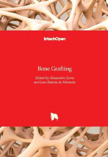 Bone grafting / edited by Alessandro Zorzi and Joao Batista de Miranda
