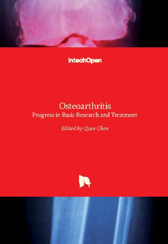 Osteoarthritis : progress in basic research and treatment / edited by Qian Chen