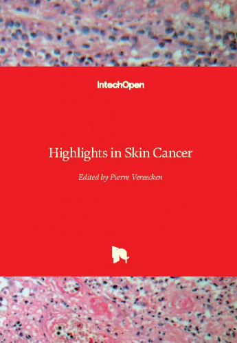 Highlights in skin cancer / edited by Pierre Vereecken
