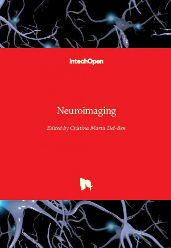 Neuroimaging / edited by Cristina Marta Del-Ben