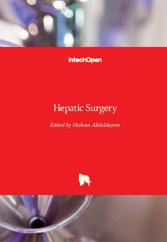 Hepatic surgery / edited by Hesham Abdeldayem