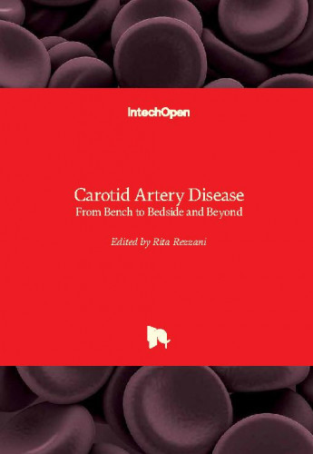 Carotid artery disease  : from bench to bedside and beyond / edited by Rita Rezzani