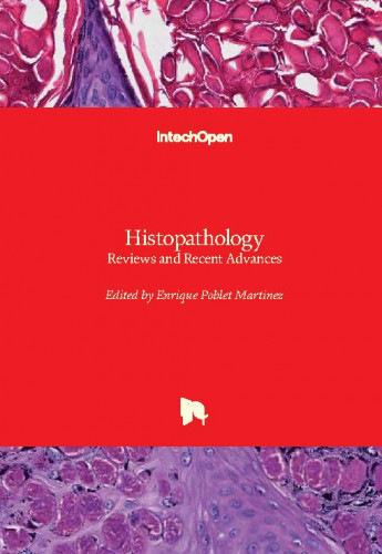 Histopathology : reviews and recent advances / edited by Enrique Poblet Martinez