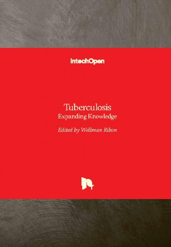 Tuberculosis : expanding knowledge / edited by Wellman Ribon