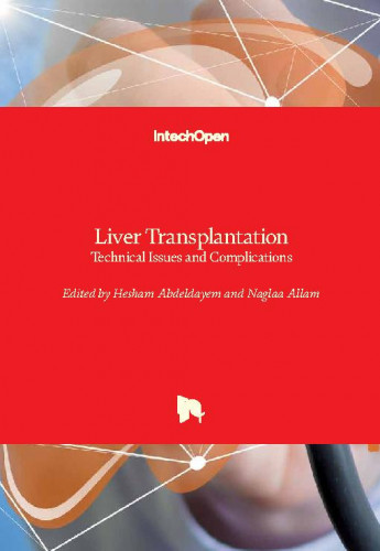 Liver transplantation - technical issues and complications / edited by Hesham Abdeldayem and Naglaa Allam