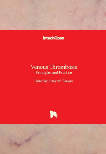 Venous thrombosis - principles and practice edited by Ertugrul Okuyan