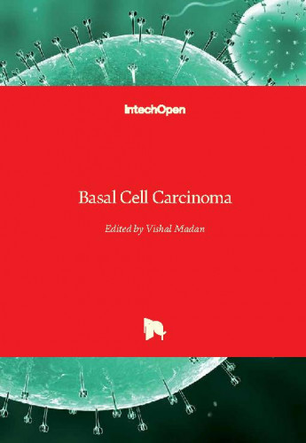Basal cell carcinoma / edited by Vishal Madan