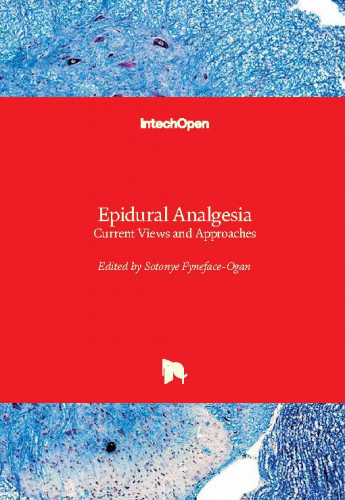 Epidural analgesia - current views and approaches / edited by Sotonye Fyneface-Ogan