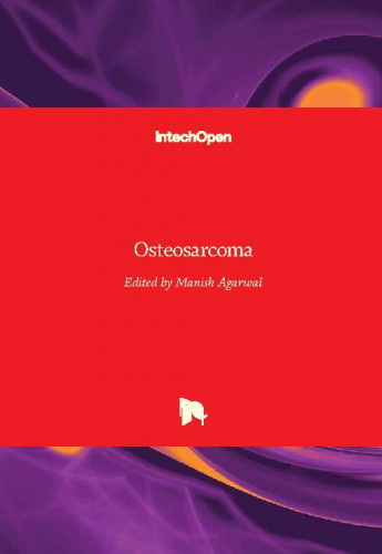 Osteosarcoma / edited by Manish Agarwal