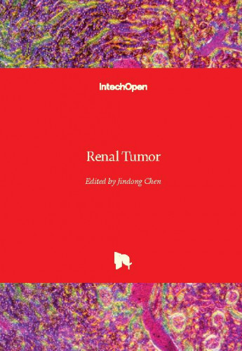 Renal tumor / edited by Jindong Chen