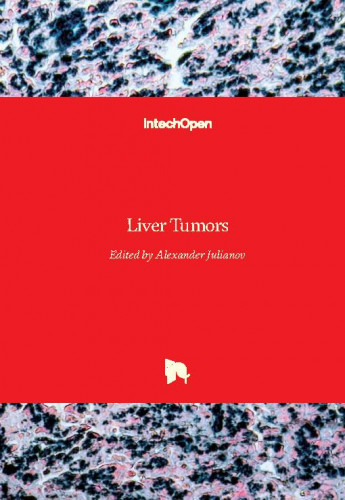 Liver tumors / edited by Alexander Julianov