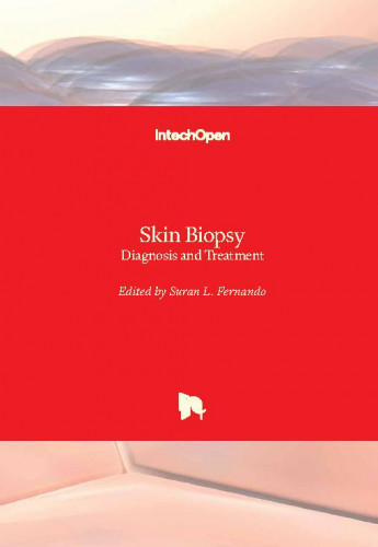 Skin biopsy : diagnosis and treatment / edited by Suran L. Fernando