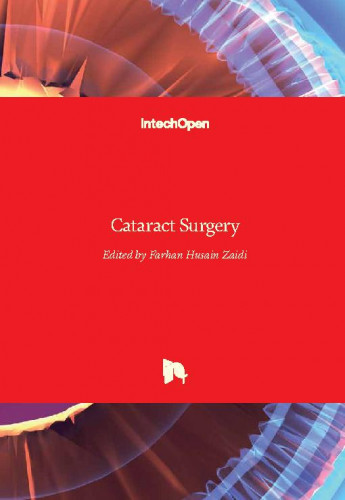 Cataract surgery / edited by Farhan Husain Zaidi
