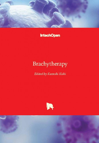 Brachytherapy / edited by Kazushi Kishi