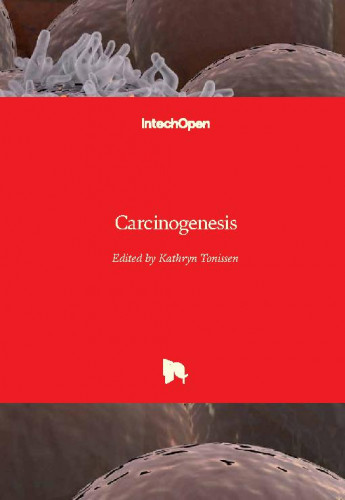 Carcinogenesis / edited by Kathryn Tonissen