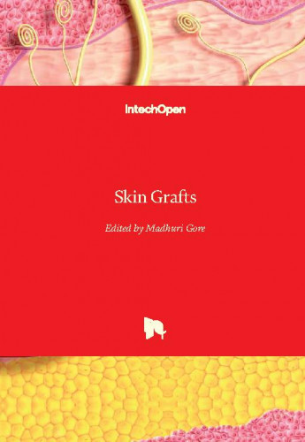Skin grafts / edited by Madhuri Gore