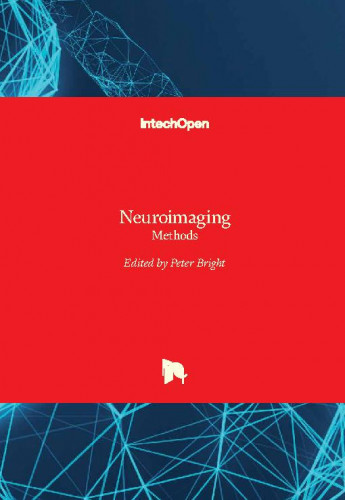 Neuroimaging - methods edited by Peter Bright