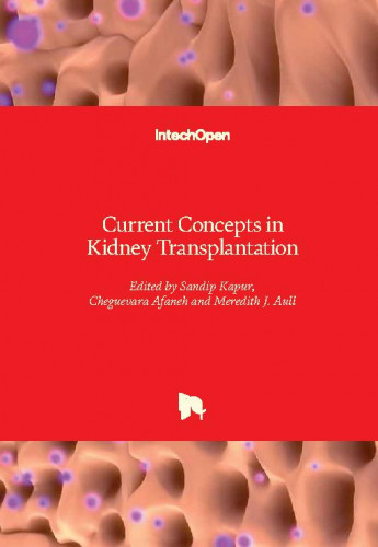 Current concepts in kidney transplantation / edited by Sandip Kapur, Cheguevara Afaneh and Meredith J. Aull