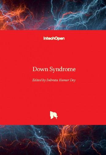 Down syndrome / edited by Subrata Kumar Dey