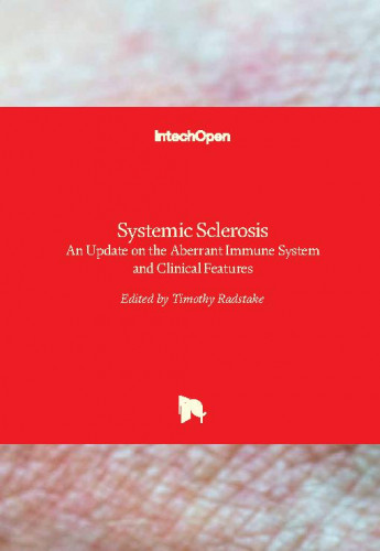 Systemic sclerosis : an update on the aberrant immune system and clinical features / edited by Timothy Radstake