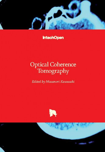 Optical coherence tomography / edited by Masanori Kawasaki