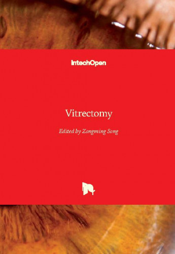Vitrectomy / edited by Zongming Song