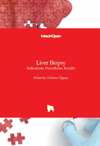 Liver biopsy : indications, procedures, results / edited by Nobumi Tagaya