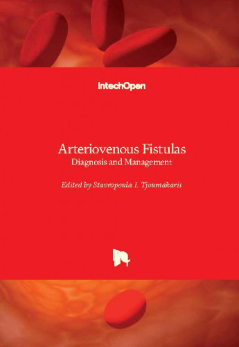 Arteriovenous fistulas : diagnosis and management / edited by Stavropoula I. Tjoumakaris