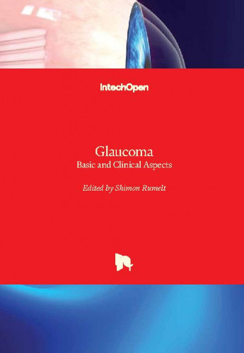 Glaucoma : basic and clinical aspects / edited by Shimon Rumelt