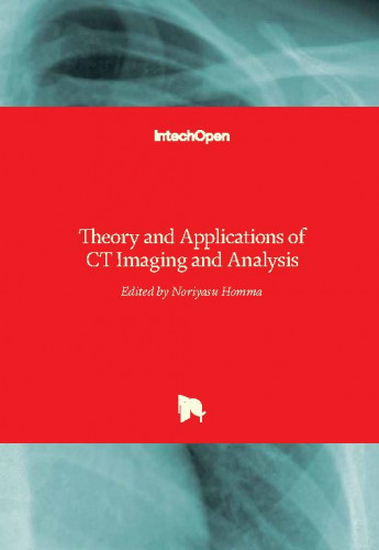 Theory and applications of CT imaging and analysis / edited by Noriyasu Homma.