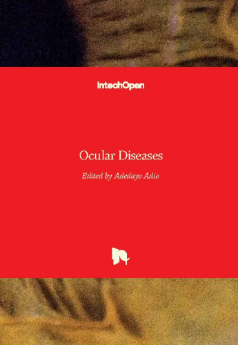 Ocular diseases / edited by Adedayo Adio