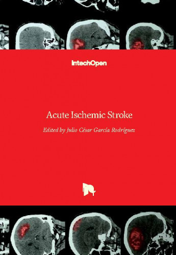 Acute ischemic stroke edited by Julio Cesar Garcia Rodriguez
