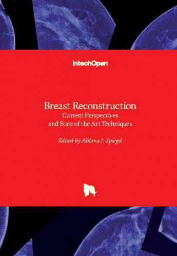 Breast reconstruction : current perspectives and state of the art techniques / edited by Aldona J. Spiegel