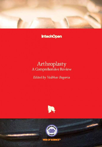Arthroplasty : a comprehensive review / edited by Vaibhav Bagaria